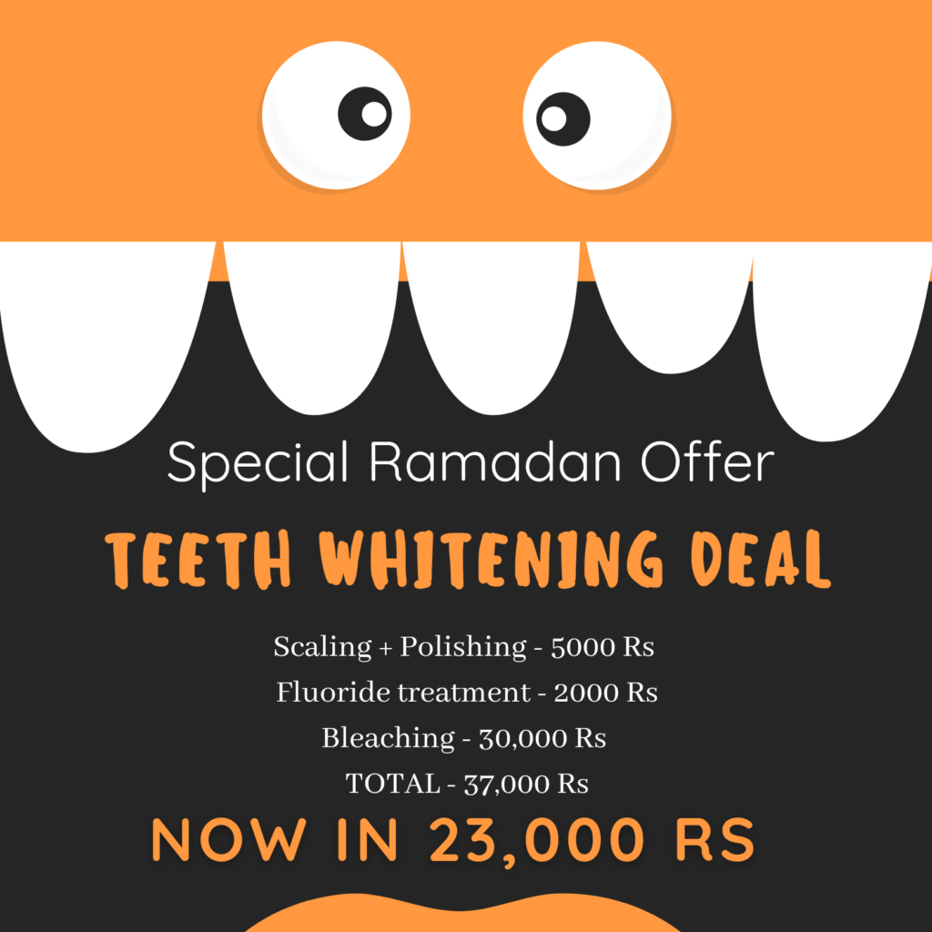 20210424_225057_00001-1024x1024 Teeth Whitening Deal